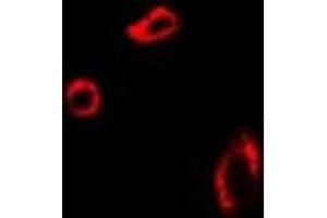 Immunofluorescent analysis of UROD staining in U2OS cells. (UROD anticorps)