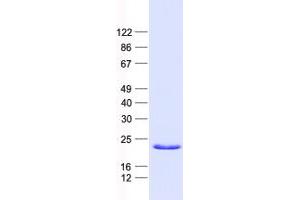 Validation with Western Blot