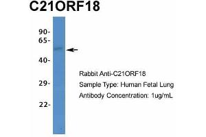 Host:  Rabbit  Target Name:  C21ORF18  Sample Type:  Human Fetal Lung  Antibody Dilution:  1. (SETD4 anticorps  (C-Term))