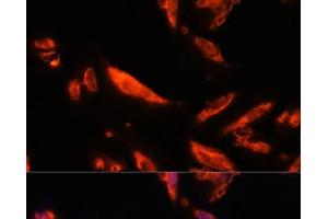 Immunofluorescence analysis of U-2 OS cells using LRRC7 Polyclonal Antibody at dilution of 1:100. (LRRC7 anticorps)