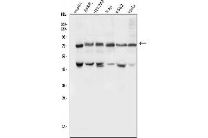 Western blot analysis of PIAS1 using anti-PIAS1 antibody (ABIN7602694).