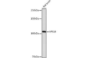 Western blot analysis of extracts of Rat brain, using VPS18 Rabbit mAb (ABIN7271274) at 1:1000 dilution. (VPS18 anticorps)