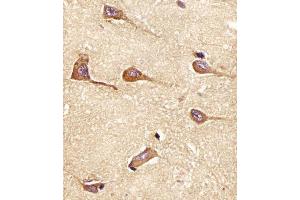 (ABIN6242187 and ABIN6577955) staining PH in Human brain tissue sections by Immunohistochemistry (IHC-P - paraformaldehyde-fixed, paraffin-embedded sections). (Amphiphysin anticorps  (AA 336-370))