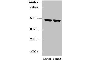 Western blot All lanes: TENT5B antibody at 6 μg/mL Lane 1: 293T whole cell lysate Lane 2: Hela whole cell lysate Secondary Goat polyclonal to rabbit IgG at 1/10000 dilution Predicted band size: 47 kDa Observed band size: 47 kDa (TENT5B (AA 2-425) anticorps)