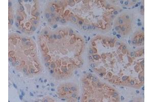 Detection of CDH17 in Human Kidney Tissue using Polyclonal Antibody to Cadherin 17 (CDH17)