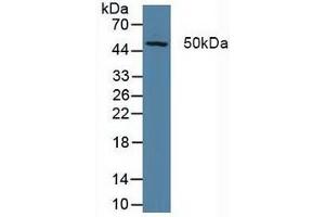 Detection of XPG in Porcine Liver Tissue using Polyclonal Antibody to Xeroderma Pigmentosum, Complementation Group G (XPG) (ERCC5 anticorps  (AA 778-986))
