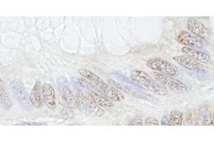 Immunohistochemistry (IHC) image for anti-Tripartite Motif Containing 33 (TRIM33) (C-Term) antibody (ABIN7448843) (TRIM33 anticorps  (C-Term))