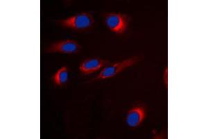 Immunofluorescent analysis of GPR18 staining in H9C2 cells. (GPR18 anticorps  (Center))