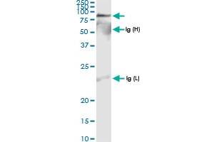 Immunoprecipitation of IDS transfected lysate using anti-IDS MaxPab rabbit polyclonal antibody and Protein A Magnetic Bead , and immunoblotted with IDS MaxPab rabbit polyclonal antibody (D01) .