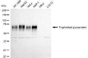 Western blotting analysis using Trophoblast glycoprotein antibody (ABIN7800649).