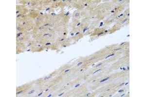 Immunohistochemistry of paraffin-embedded Rat heart using RAB24 Polyclonal Antibody at dilution of 1:100 (40x lens). (RAB24 anticorps)
