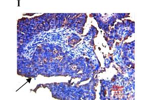 Expression of SPARC in human ovarian tissues using antibody AF941 and bs-1133R.