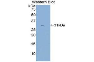 Western Blotting (WB) image for anti-Cytochrome P450, Family 21, Subfamily A, Polypeptide 2 (CYP21A2) (AA 37-264) antibody (ABIN3206433) (CYP21A2 anticorps  (AA 37-264))