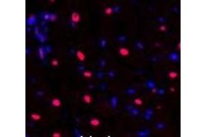 Immunofluorescence analysis of Rat heart tissue using NFκB-p105/p50 Polyclonal Antibody at dilution of 1:200. (NFKB1 anticorps)