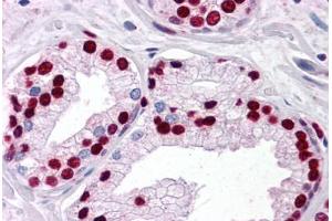 Human Prostate: Formalin-Fixed, Paraffin-Embedded (FFPE) (SMAD6 anticorps  (AA 285-385))