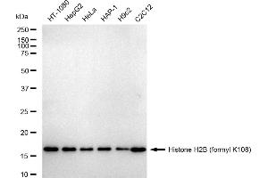 Western blotting analysis using Histone H2B (formyl K108) antibody (ABIN7798947).