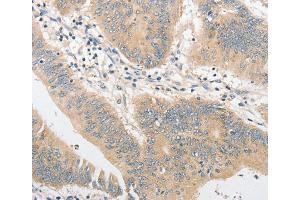 Immunohistochemistry (IHC) image for anti-Toll-Like Receptor 4 (TLR4) antibody (ABIN2422732) (TLR4 anticorps)