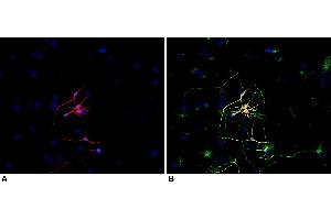 Immunocytochemistry staining of P-19 mouse embryonal carcinoma cell line stimulated to neuronal differentiation by retinoic acid.