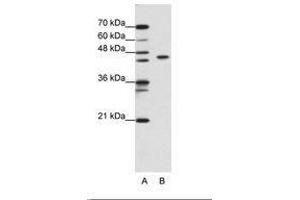 Image no. 2 for anti-Zinc Finger and BTB Domain Containing 9 (ZBTB9) (N-Term) antibody (ABIN6736184) (ZBTB9 anticorps  (N-Term))