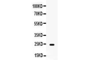 Western blot analysis of FGF1 expression in rat cardiac muscle extract ( Lane 1). (FGF1 anticorps  (AA 16-155))