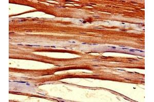 Immunohistochemistry of paraffin-embedded human skeletal muscle tissue using ABIN7172041 at dilution of 1:100 (TMX2 anticorps  (AA 49-102))