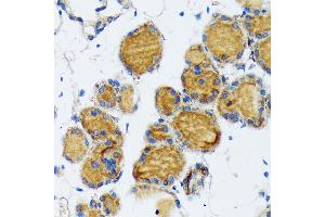 Immunohistochemistry of paraffin-embedded mouse thyroid using Thyroid Peroxidase Rabbit mAb (ABIN7270865) at dilution of 1:100 (40x lens). (TPO anticorps)
