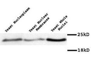 Western blot of Mad2p polyclonal antibody  on yeast preparation. (MAD2 anticorps)
