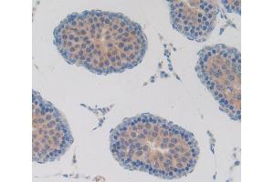 Used in DAB staining on fromalin fixed paraffin- embedded testis tissue (T-Bet anticorps  (AA 241-493))