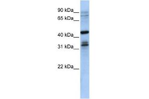 WB Suggested Anti-MSI2 Antibody Titration:  0. (MSI2 anticorps  (N-Term))
