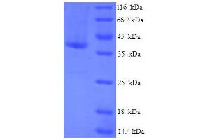 SDS-PAGE (SDS) image for CASP2 and RIPK1 Domain Containing Adaptor with Death Domain (CRADD) (AA 1-199), (full length) protein (His-SUMO Tag) (ABIN5709321)