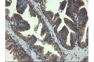 Image no. 8 for anti-Ubiquitin-Conjugating Enzyme E2, J1, U (UBE2J1) antibody (ABIN1501638)