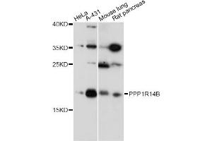 Western blot analysis of extracts of various cell lines, using PPP1R14B antibody (ABIN6294069) at 1:1000 dilution. (PPP1R14B anticorps)