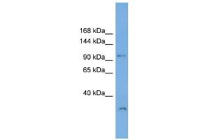 WB Suggested Anti-DENND1A Antibody Titration: 0. (DENND1A anticorps  (N-Term))