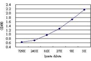 LIPA (Human) Matched Antibody Pair