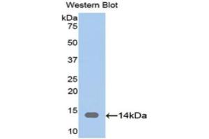 Western Blotting (WB) image for anti-CAP, Adenylate Cyclase-Associated Protein 1 (CAP1) (AA 38-149) antibody (ABIN1174519) (CAP1 anticorps  (AA 38-149))