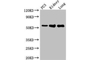 Western Blot Positive WB detected in: PC-3 whole cell lysate, Mouse kidney tissue, Mouse lung tissue All lanes: MMP13 antibody at 2 μg/mL Secondary Goat polyclonal to rabbit IgG at 1/50000 dilution Predicted band size: 54 kDa Observed band size: 54 kDa (MMP13 anticorps  (AA 104-471))