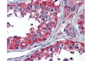 Immunohistochemistry (IHC) image for anti-Neuropeptide Y Receptor Y1 (NPY1R) (Middle Region) antibody (ABIN2777014)