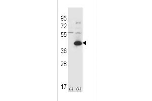 Western blot analysis of GOT1 (arrow) using rabbit polyclonal GOT1 Antibody (C-term) (ABIN650770 and ABIN2839551).