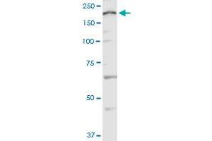 CACNA1C polyclonal antibody (A01).