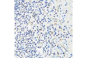 Immunohistochemistry of paraffin-embedded human appendix using  antibody (ABIN7265374) at dilution of 1:100 (40x lens).