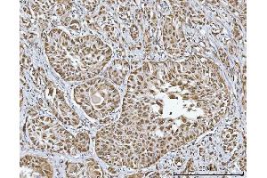 IHC analysis of TRMT10C using anti-TRMT10C antibody (ABIN7601472).