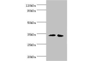 Western blot All lanes: RPH3AL antibody at 12 μg/mL Lane 1: LO2 whole cell lysate Lane 2: K562 whole cell lysate Secondary Goat polyclonal to rabbit IgG at 1/10000 dilution Predicted band size: 35, 32 kDa Observed band size: 35 kDa (RPH3AL anticorps  (AA 161-315))