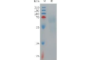 Human IL12A & IL12B Heterodimer Protein, hFc Tag & His Tag on SDS-PAGE under reducing condition.