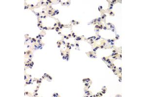 Immunohistochemistry of paraffin-embedded rat lung using RNF2 antibody (ABIN5973244) at dilution of 1/100 (40x lens).
