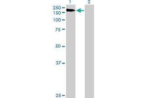Western Blot analysis of AGL expression in transfected 293T cell line by AGL MaxPab polyclonal antibody.