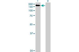 Western Blot analysis of AGL expression in transfected 293T cell line by AGL MaxPab polyclonal antibody. (AGL anticorps  (AA 1-1532))