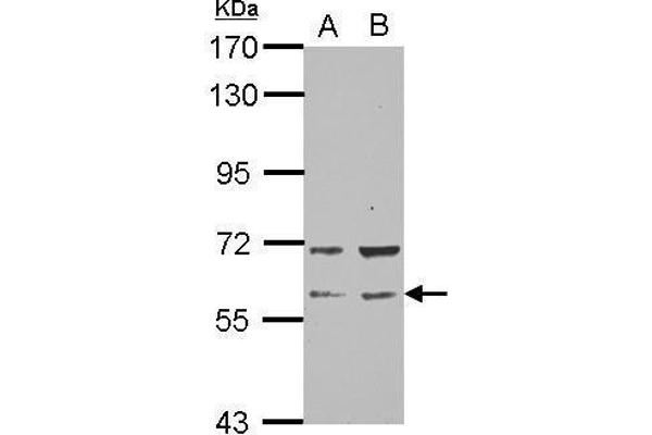 RAP1GDS1 anticorps  (N-Term)