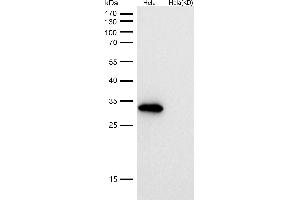 All lanes use the Antibody at 1:1K dilution for 1 hour at room temperature.
