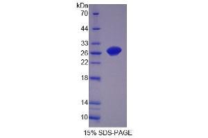 SDS-PAGE analysis of Rat OPHN1 Protein. (Oligophrenin 1 Protein (OPHN1))