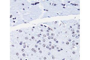 Immunohistochemistry of paraffin-embedded Mouse brain using Acetyl-Histone H4-K8 Polyclonal Antibody at dilution of 1:100 (40x lens).